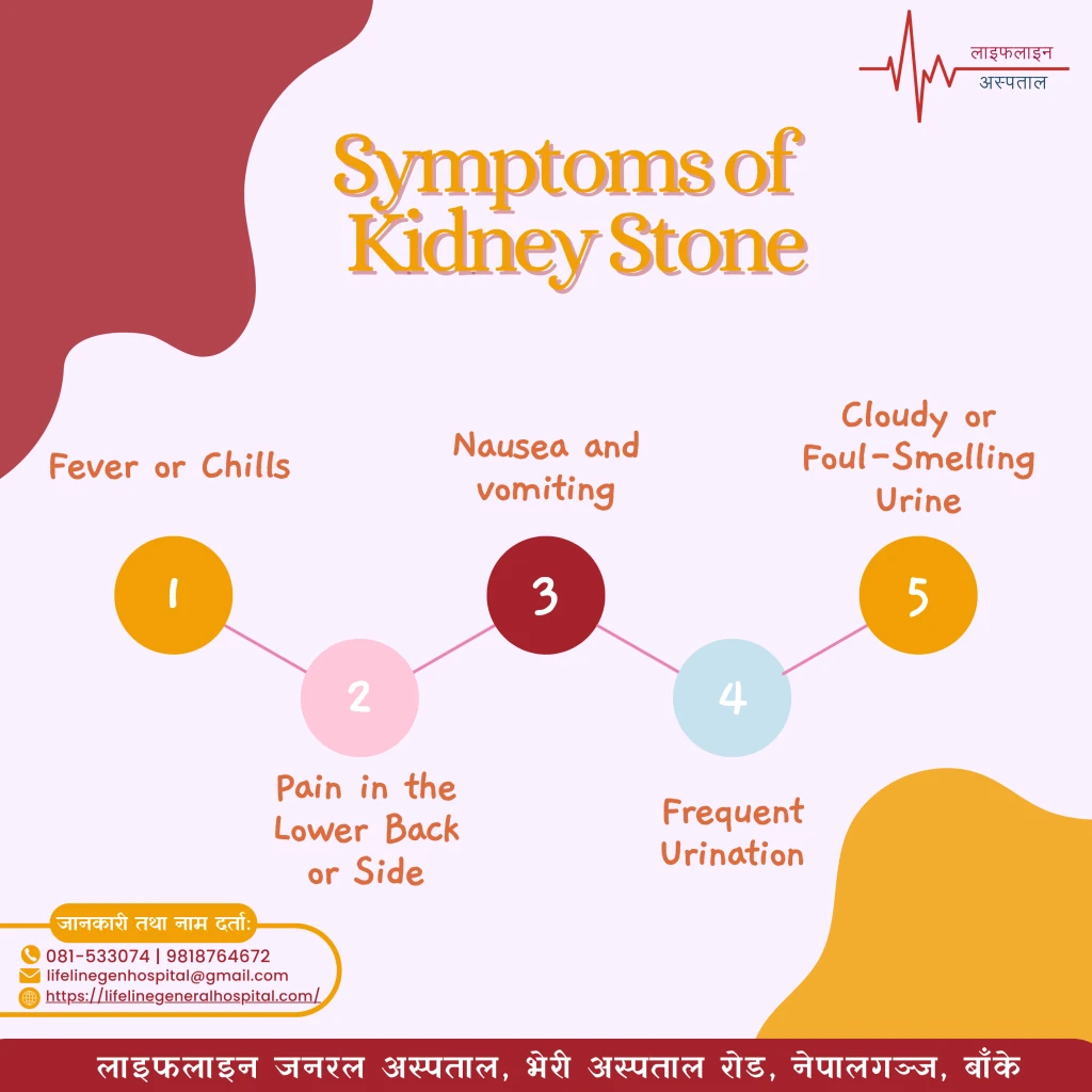 Symptoms of Kidney stone.